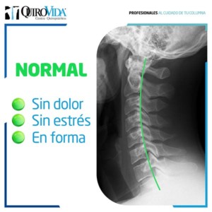Dolor de cuello
