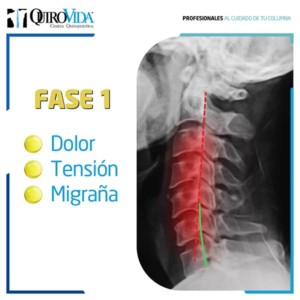 Dolor de cuello
