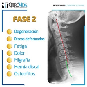 Dolor de cuello